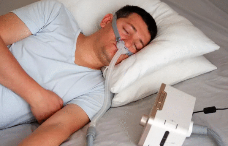 SLEEP APNEA