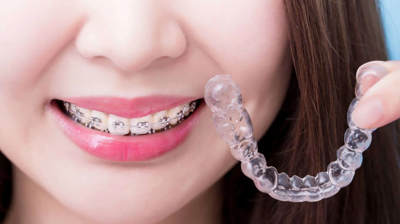 Why More Adults in Colorado Are Choosing Invisalign Over Traditional Braces